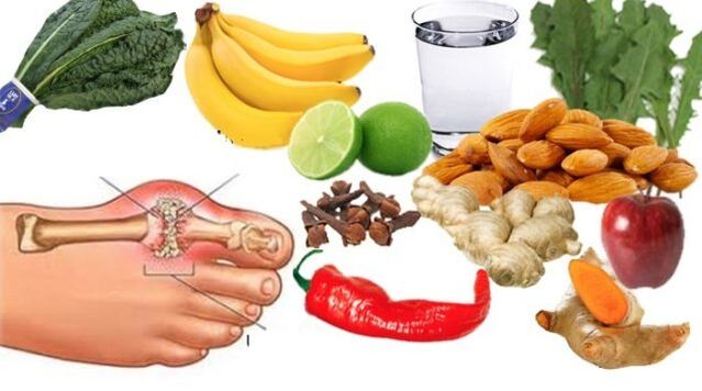Ai pazienti con gotta viene prescritta una dieta moderata